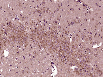 SLC25A18 Rabbit Polyclonal Antibody