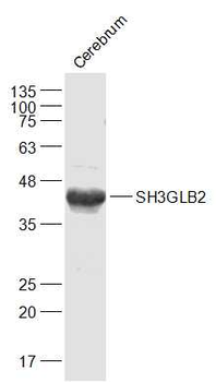 SH3GLB2 Rabbit Polyclonal Antibody