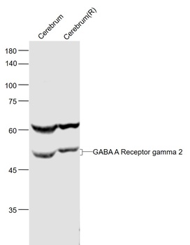 GABA A Receptor gamma 2 antibody
