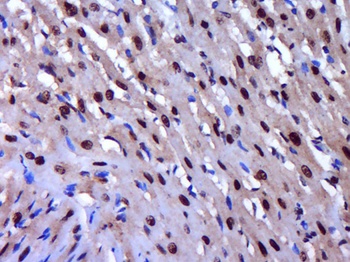 Histone H2A.X (phospho-Tyr143) antibody