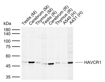 HAVCR1 Rabbit Polyclonal Antibody