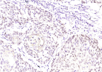 P63 (ready to use) Mouse Monoclonal Antibody