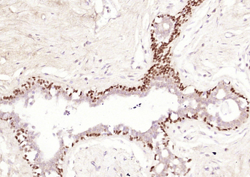 P63 (ready to use) Mouse Monoclonal Antibody
