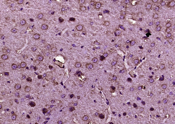 TrkB Rabbit Polyclonal Antibody