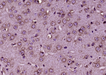 TrkB Rabbit Polyclonal Antibody