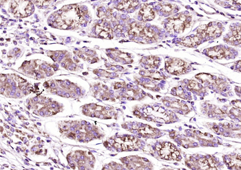 PRKD1/PKC mu Rabbit Polyclonal Antibody