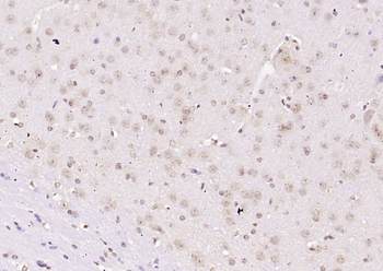 SOX6 Rabbit Polyclonal Antibody