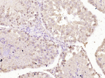 GCNF Rabbit Polyclonal Antibody