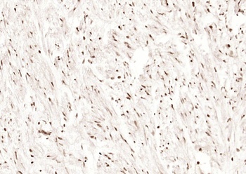 BRCA1 (phospho-Ser1466) antibody