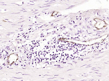 CD31 (ready to use) Mouse Monoclonal Antibody