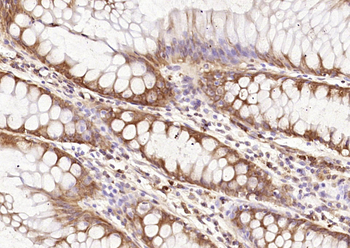 PRDX2 Rabbit Polyclonal Antibody