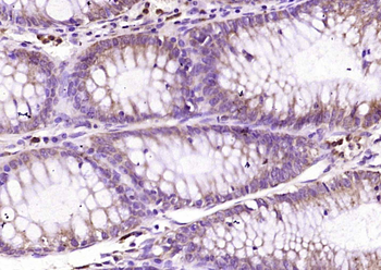 Beta-arrestin 1 + 2 Rabbit Polyclonal Antibody