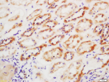 GSTP1 Rabbit Polyclonal Antibody