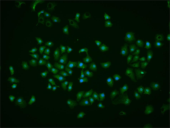 HSF1 Rabbit Polyclonal Antibody