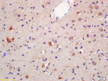 HSD17B3 Rabbit Polyclonal Antibody