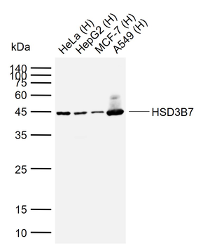 HSD3B7 Rabbit Polyclonal Antibody