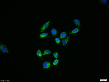 HSP27 (phospho-Ser78) antibody