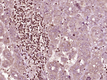 Phospho-HSP70 (Tyr525) Rabbit Polyclonal Antibody