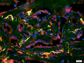 IDH2 Rabbit Polyclonal Antibody