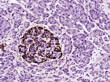 IDI1 Rabbit Polyclonal Antibody