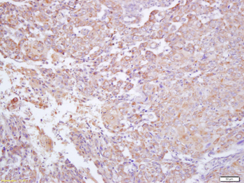IFNGR2 Rabbit Polyclonal Antibody