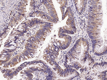 Phospho-IKK beta (S474) Rabbit Polyclonal Antibody