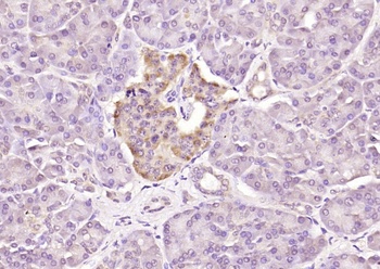 IKK gamma (phospho-Ser31) antibody