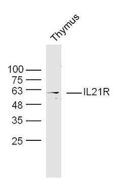 IL21R Rabbit Polyclonal Antibody