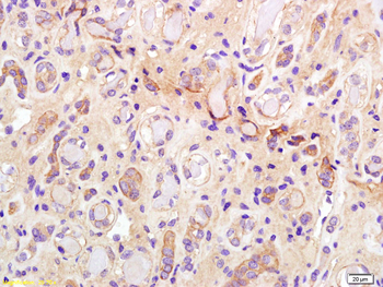 Phospho-IRS1 (Ser307) Rabbit Polyclonal Antibody