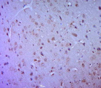 LAMC1 Rabbit Polyclonal Antibody