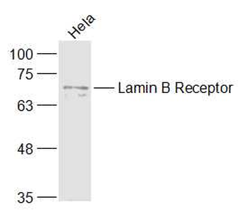 Lamin B Receptor Rabbit Polyclonal Antibody