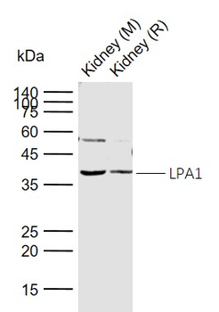 LPA1 Rabbit Polyclonal Antibody