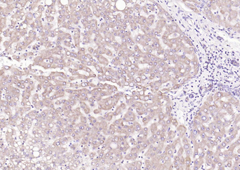 LRP5 Rabbit Polyclonal Antibody