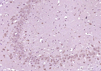 Phospho-PKA alpha + beta (Thr198) Rabbit Polyclonal Antibody