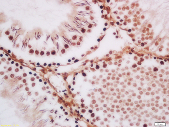 TLK1 Rabbit Polyclonal Antibody