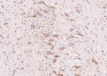 CTNND2/delta 2 Catenin Rabbit Polyclonal Antibody