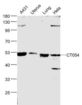 CT054 Rabbit Polyclonal Antibody