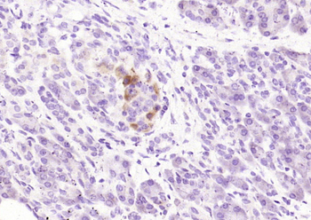 Rab27a Rabbit Polyclonal Antibody