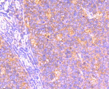 BCL2A1 Recombinant Rabbit Monoclonal Antibody