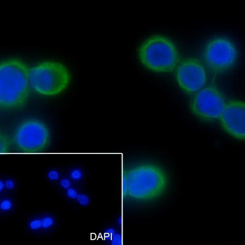 CK20 Recombinant Rabbit Monoclonal Antibody