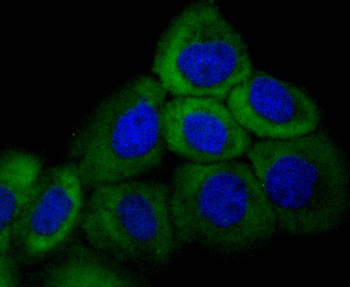 Cytokeratin 16 Recombinant Rabbit Monoclonal Antibody