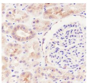 HDAC6 Recombinant Rabbit Monoclonal Antibody