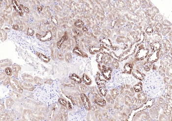 Glycogen Synthase 1 (phospho-Ser641) antibody