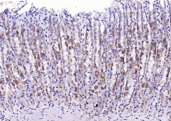 EGFR (phospho-Ser695) antibody