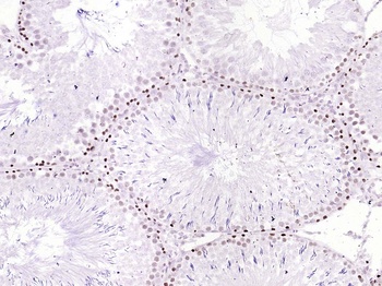 C-Myc (phospho-Ser62) antibody