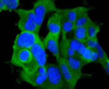Phospho-RPS6KA1 (Ser380) Recombinant Rabbit Monoclonal Antibody