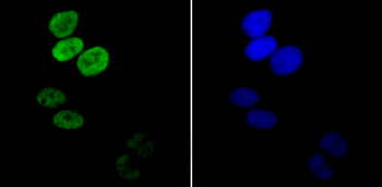 Histone H3 (acetyl K14) Recombinant Rabbit Monoclonal Antibody