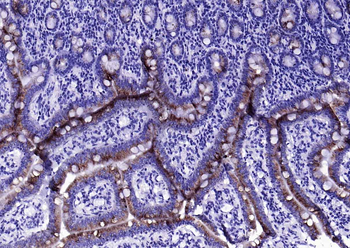 AGR2 Recombinant Rabbit Monoclonal Antibody