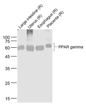 PPAR Gamma antibody