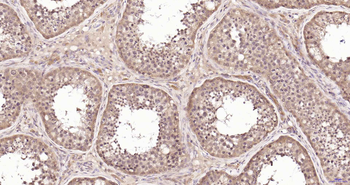 PIK3R2 Recombinant Rabbit Monoclonal Antibody